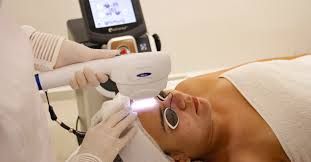 LIP - Luz Intensa Pulsada